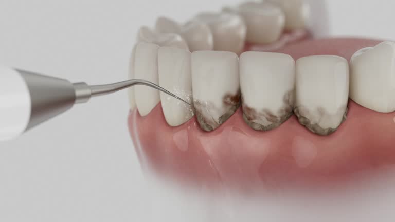 Reliable Dental Implants contractor in Forsyth County County, NC by Dentist Open Now